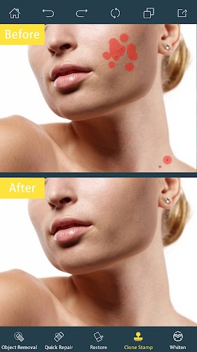 Photo Retouch- Object Removal Screenshot2