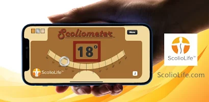 Scoliometer App Screenshot1