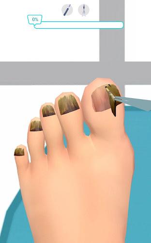 Foot Clinic - ASMR Feet Care Screenshot11