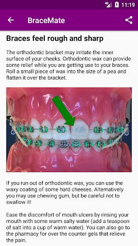 BraceMate Screenshot5