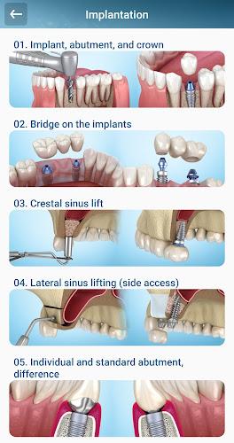 Dental 3D Illustrations Screenshot3