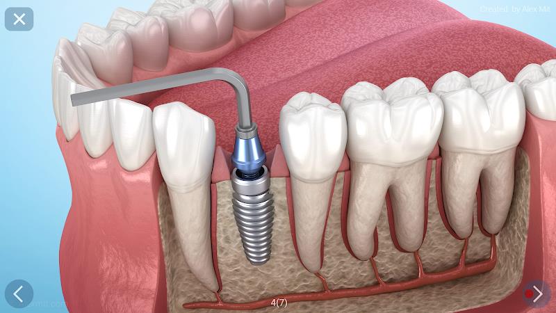 Dental 3D Illustrations Screenshot26