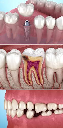 Dental 3D Illustrations Screenshot7