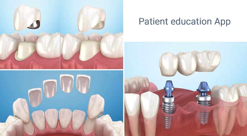 Dental 3D Illustrations Screenshot14