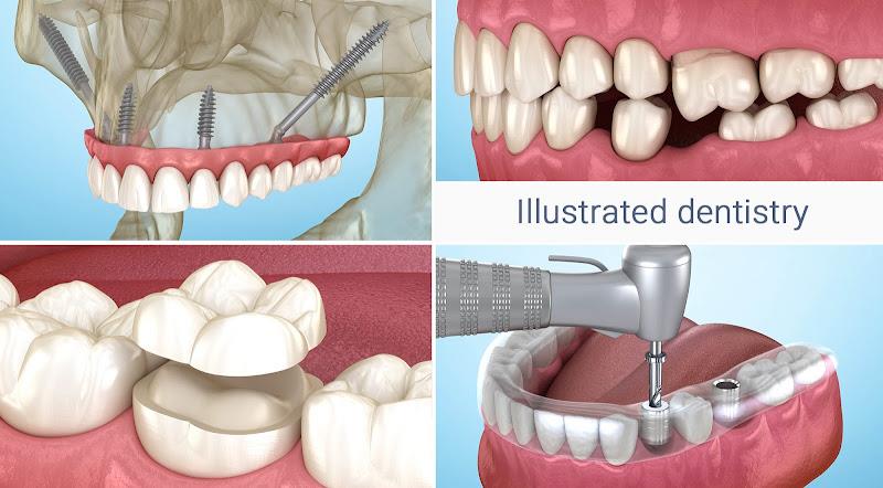 Dental 3D Illustrations Screenshot13