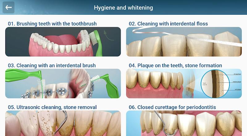 Dental 3D Illustrations Screenshot16