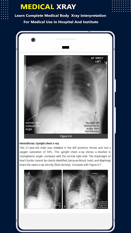 X-Ray Interpretation Guide Screenshot1