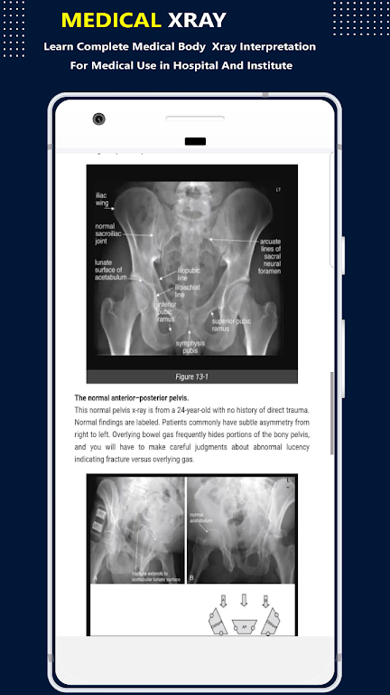 X-Ray Interpretation Guide Screenshot2