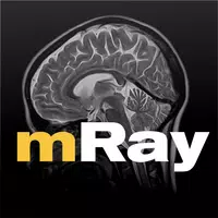 mRay APK