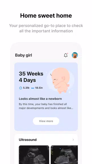 Momitalk: Pregnancy Ultrasound Screenshot3