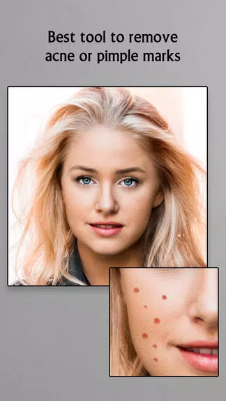 Remove Acne from Face Screenshot2