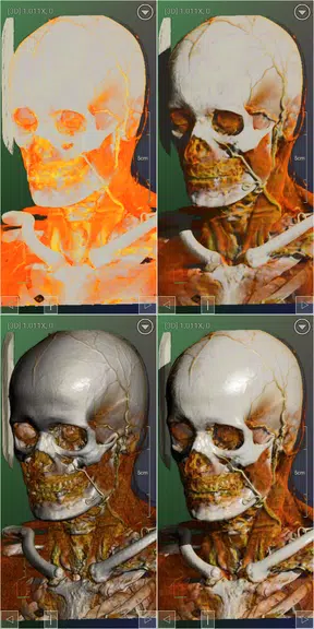 DroidRender - 3D DICOM viewer Screenshot2