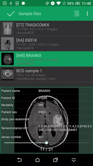 DroidRender - 3D DICOM viewer Screenshot4