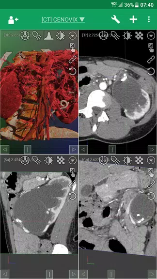 DroidRender - 3D DICOM viewer Screenshot1