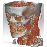 DroidRender - 3D DICOM viewer APK