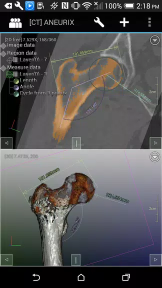 DroidRender - 3D DICOM viewer Screenshot3