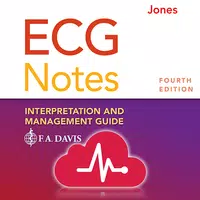 ECG Notes: Quick look-up ref. APK