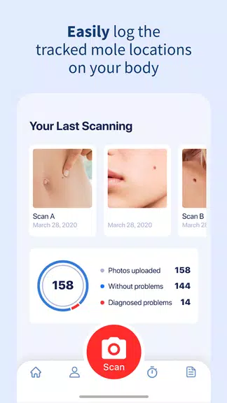 AI Dermatologist: Skin Scanner Screenshot3