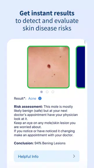 AI Dermatologist: Skin Scanner Screenshot4